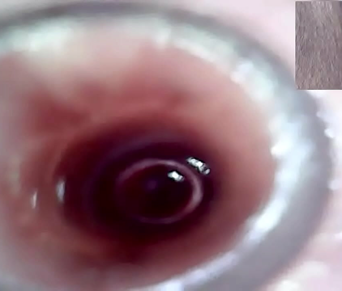 Experience the Joy of Lesbian Cervix Play and Peehole Fucking with a Golden Dildo!