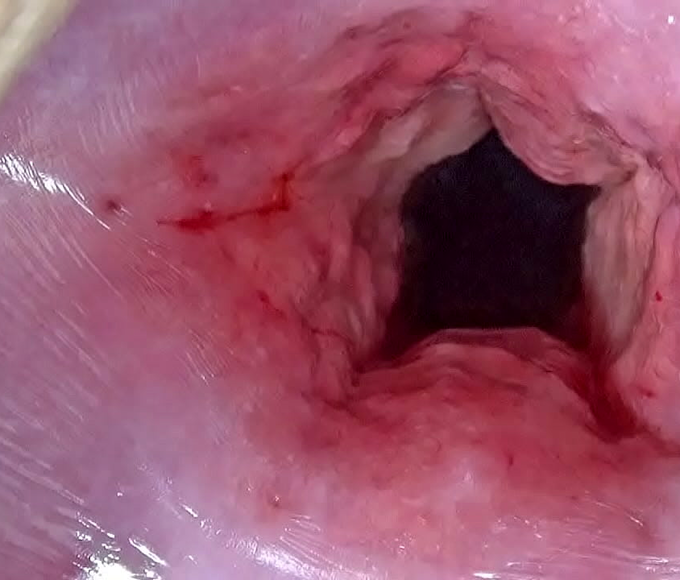 Getting Intimate with Japanese Cervix Stretching and Uterus Dilation with Penetration